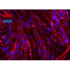 iXCellsΓäó Human iPSC-Derived Myoblasts